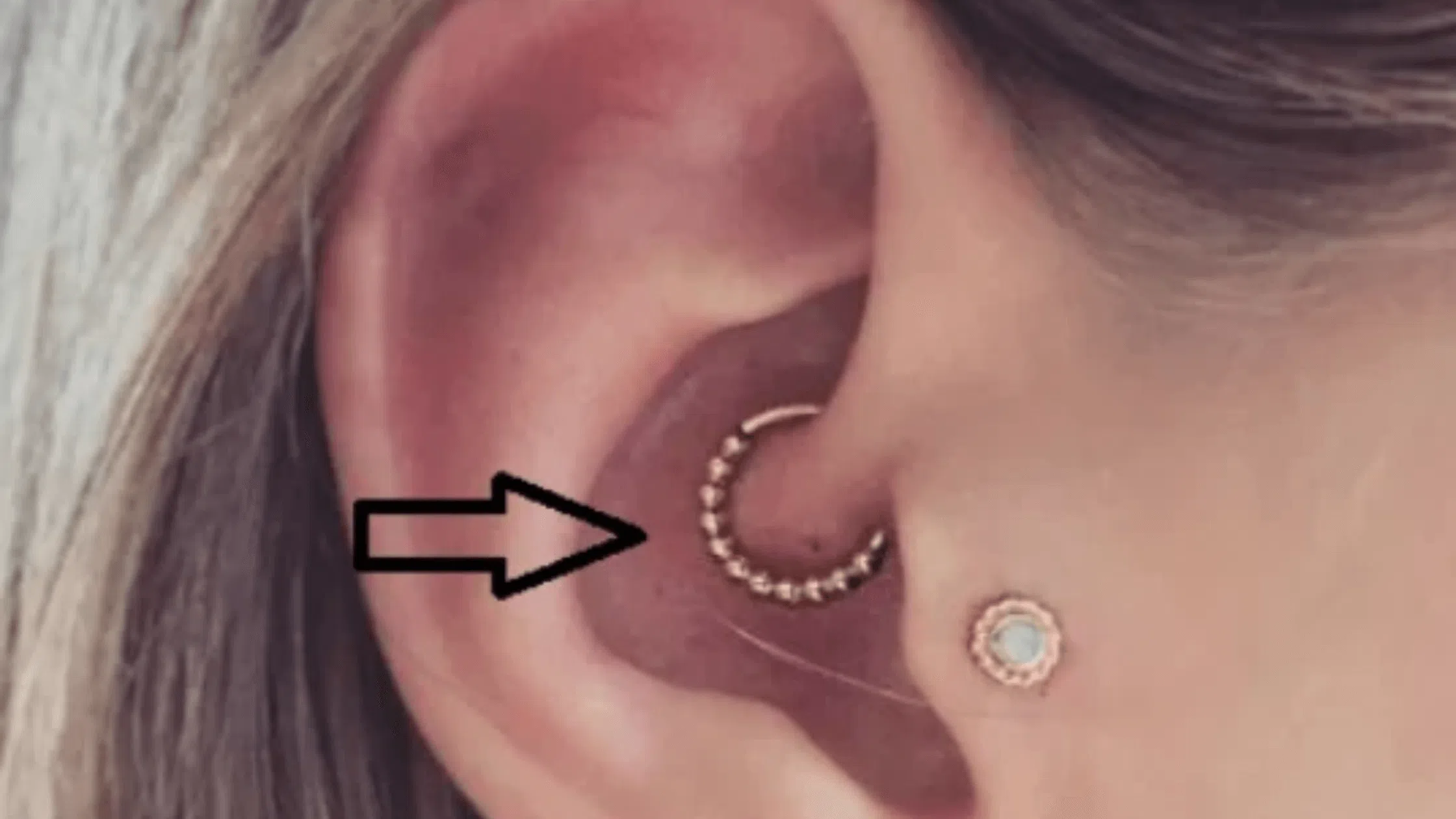 daith piercing